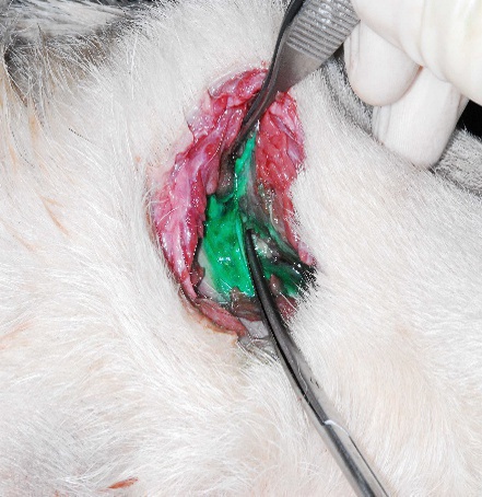 Dissected nerve block